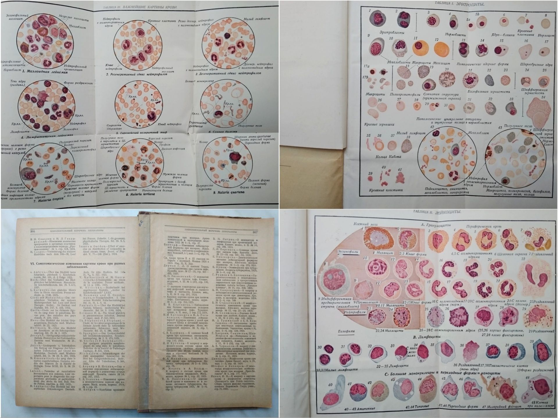 "1926 г! Картина крови и её клиническое значение. В. Шиллинг"