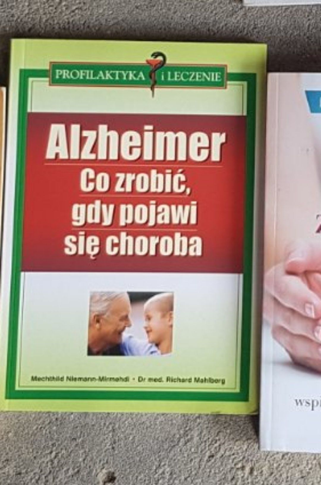 Alzheimer co zrobic.gdy pojawi sie choroba