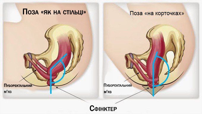 Стілець для полегшенного походу до туалету