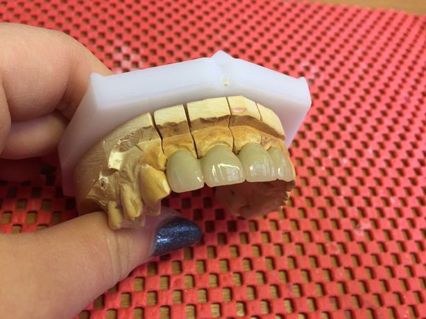 Зубной техник ( зуботехнические услуги)