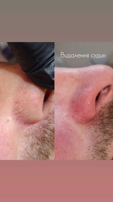 Косметолог, епіляція, корекція фігури