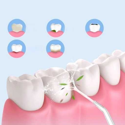 Irygator do zębów bezprzewodowy dentystyczny mocny 3 TRYBY 220 ML