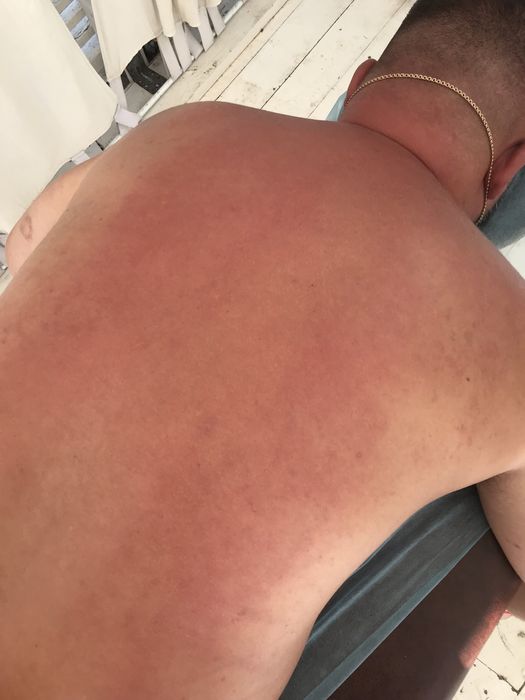 Лікувальний масаж