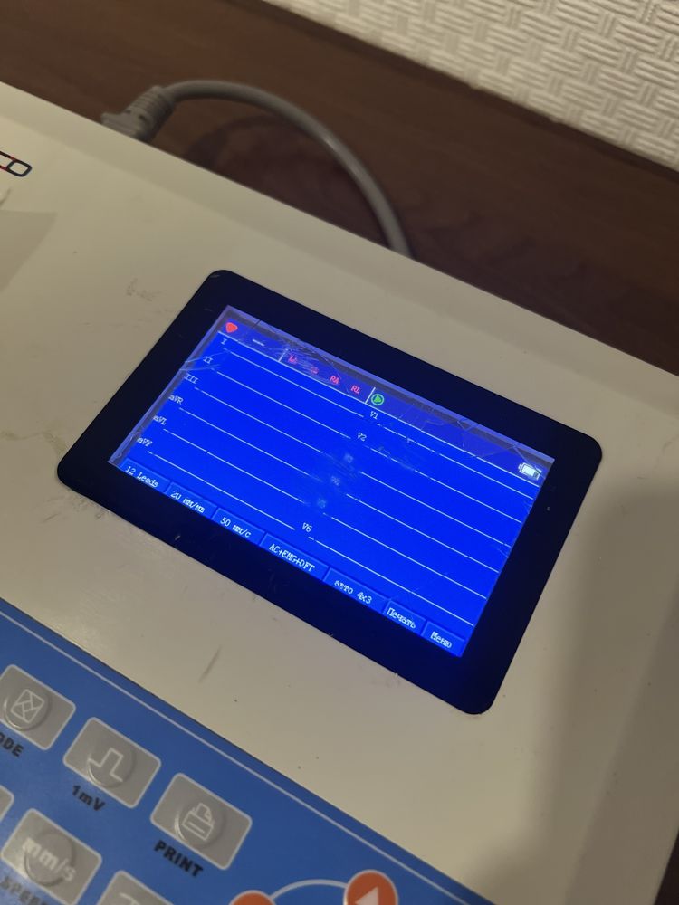 Кардіограф Електрокардіограф ECG300G LCD