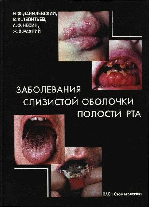 АТЛАС Заболевания слизистои полости рта Н.Ф.Данилевскии  книги
