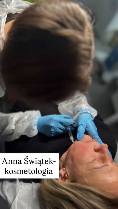 Kosmetolog | Stymulatory tkankowe,Mezoterapia igłowa, mikroigłowa