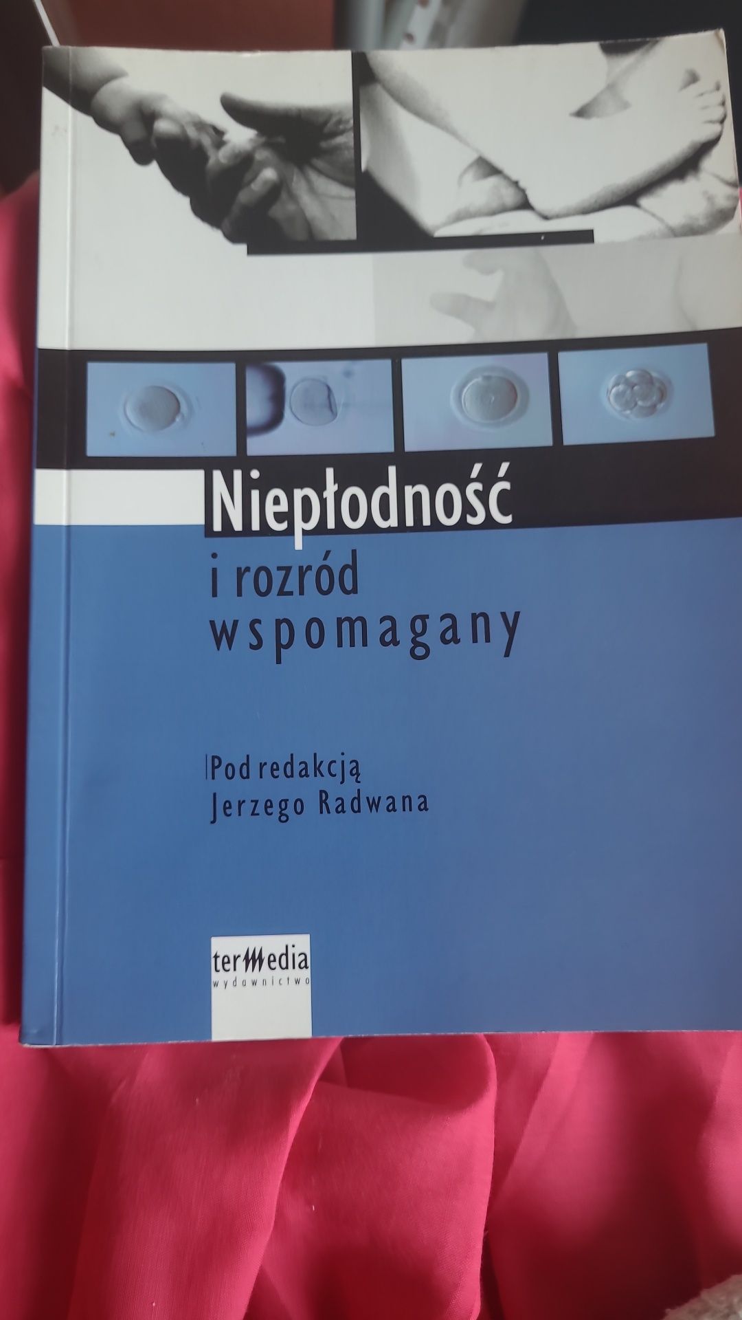 Niepłodność i rozród wspomagany J. Radwan