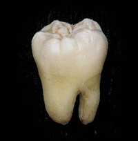 Зуб людський для навчання  стоматологів