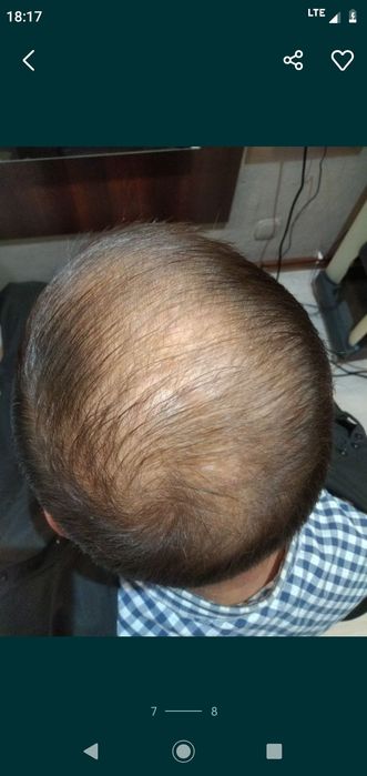 Toppik na zagęszczanie włosów oraz maskowanie siwych odrostów, medium