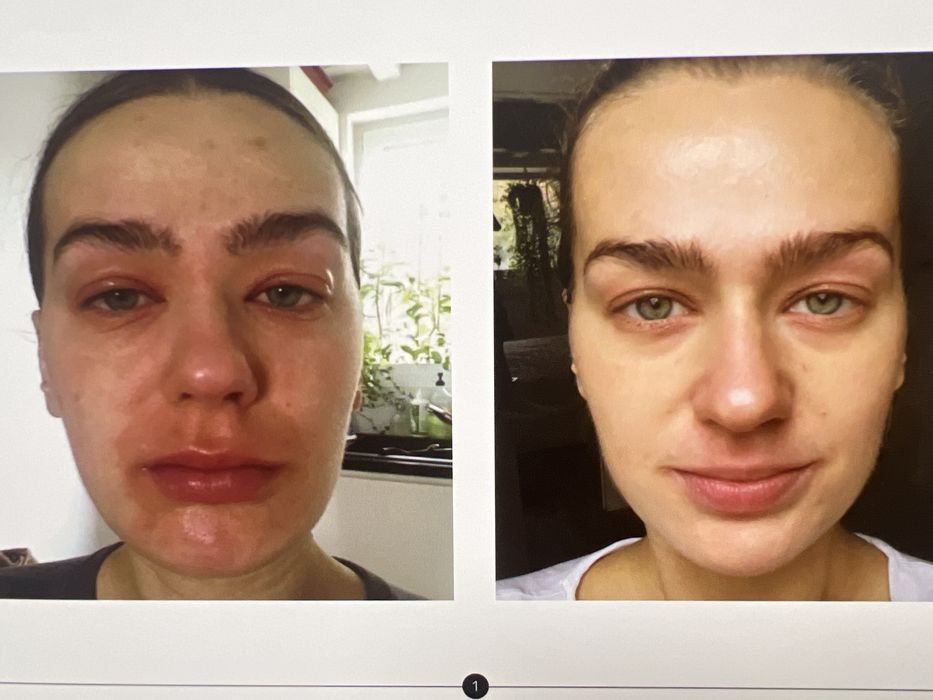 Pro XN Antioxidant Therapy LIGHT Serum wersja gabinetowa