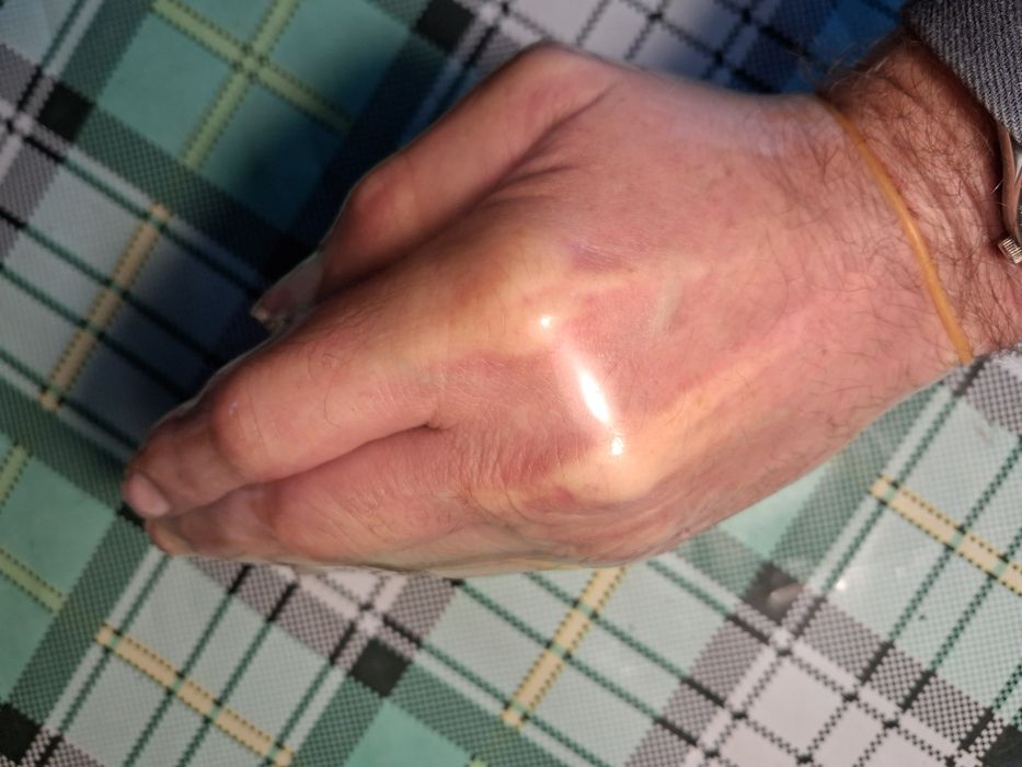 Продам просроченые презервативы в Харькове