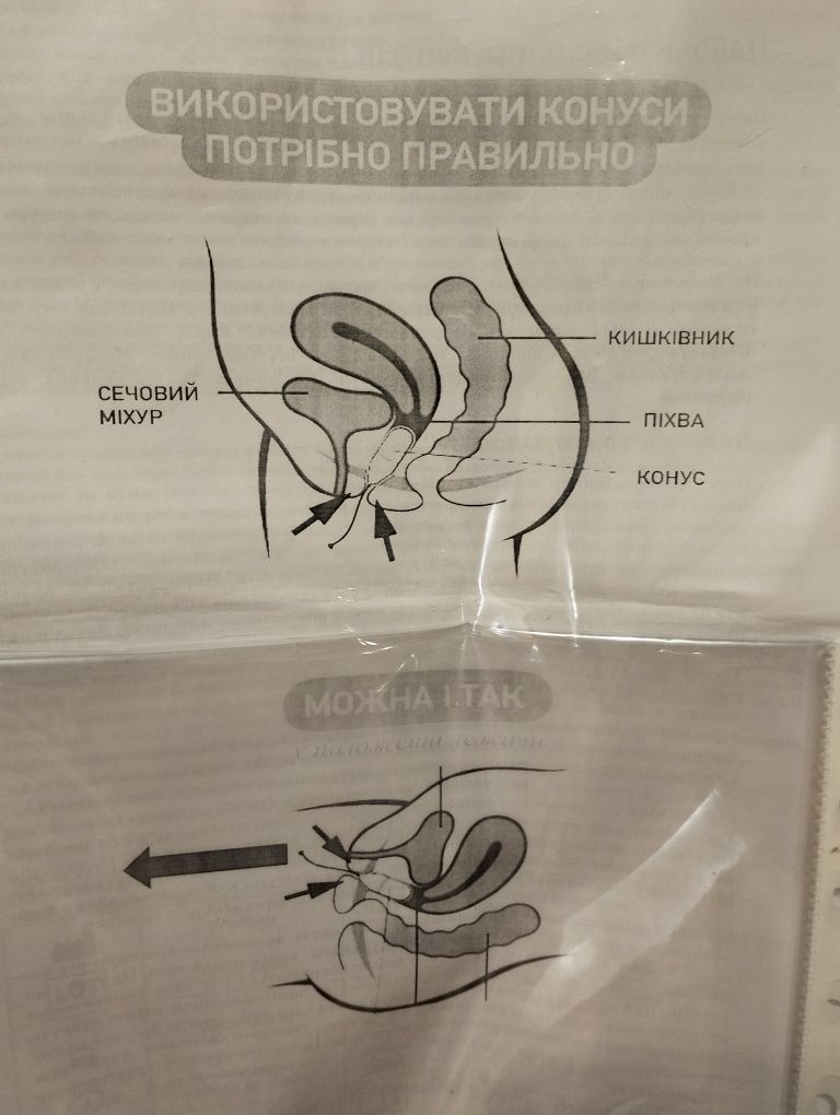 Вагінальні конуси