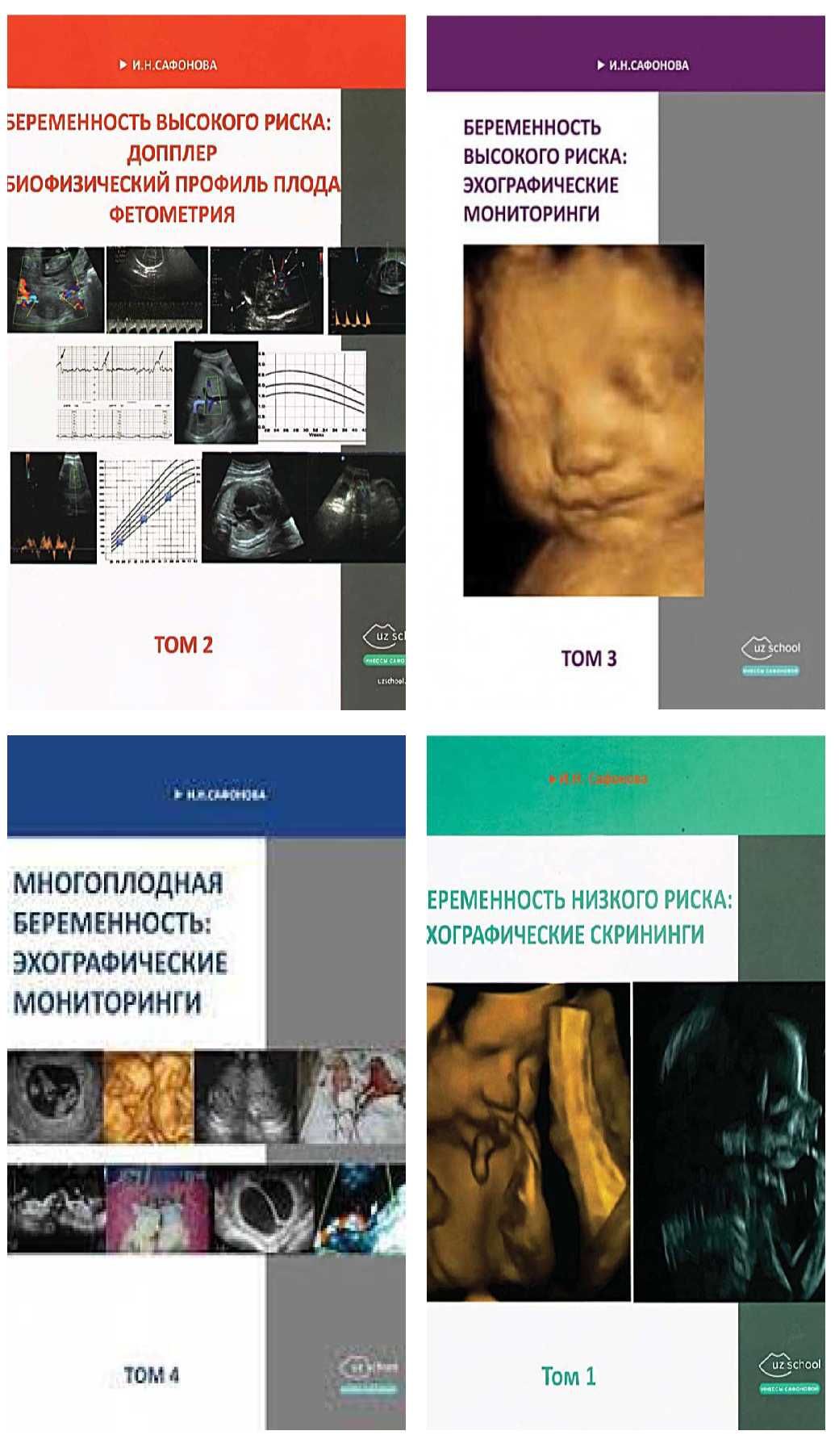 Беременность высокого риска Сафонова
