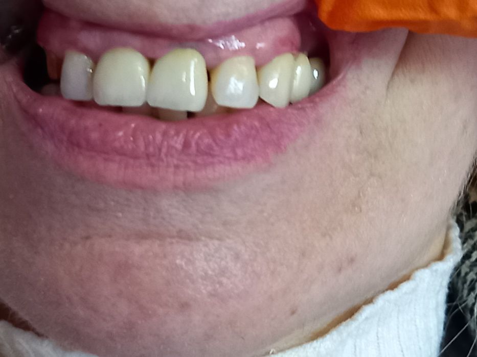 Зуботехнічна лабораторія Stom-tex zt  , пропонує співпрацю лікарям