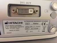 Портативний УЗД апарат HITACHI