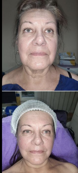 Масаж обличчя  моделюючий,лімфодренажний,міофасціальний м Голосеевская