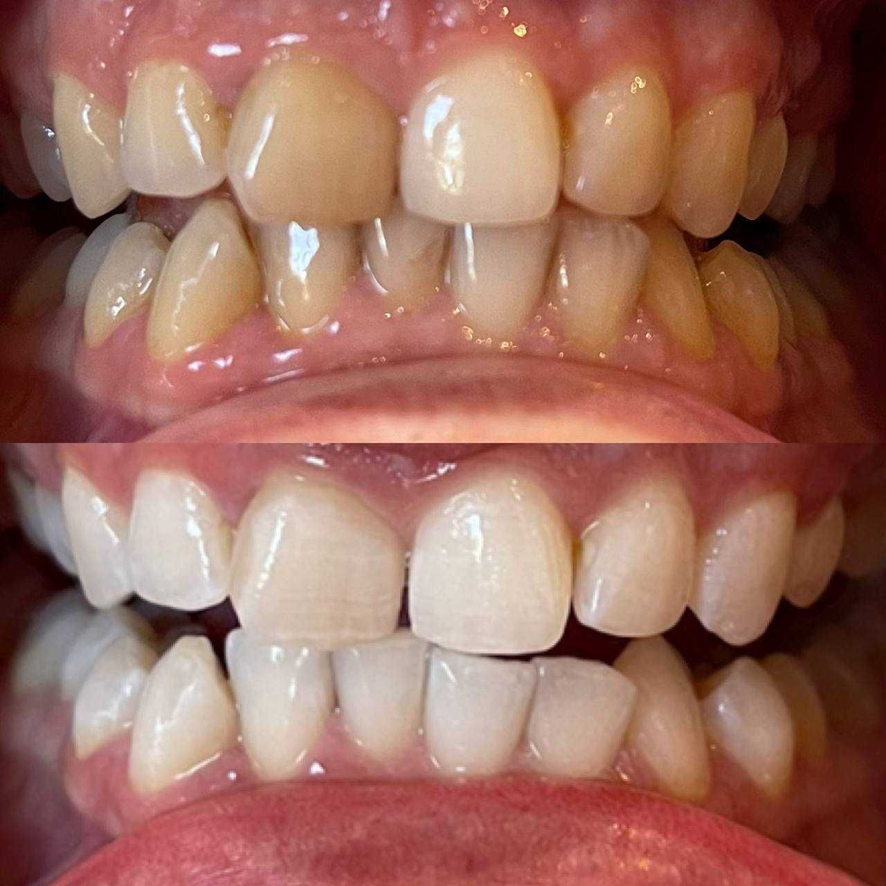 Косметичний бізнес / Франшиза відбілювання зубів Smile LAB