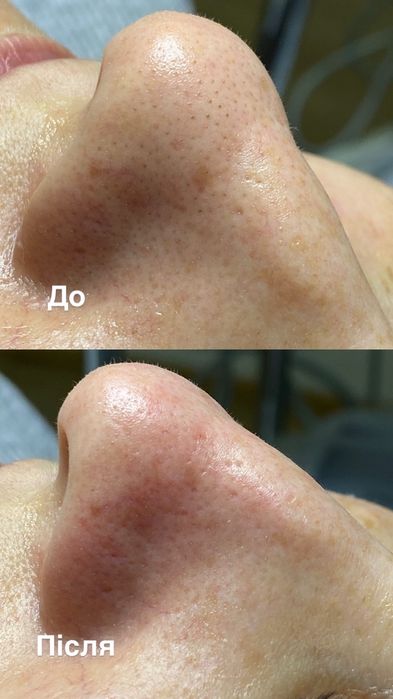 Послуги Косметолога