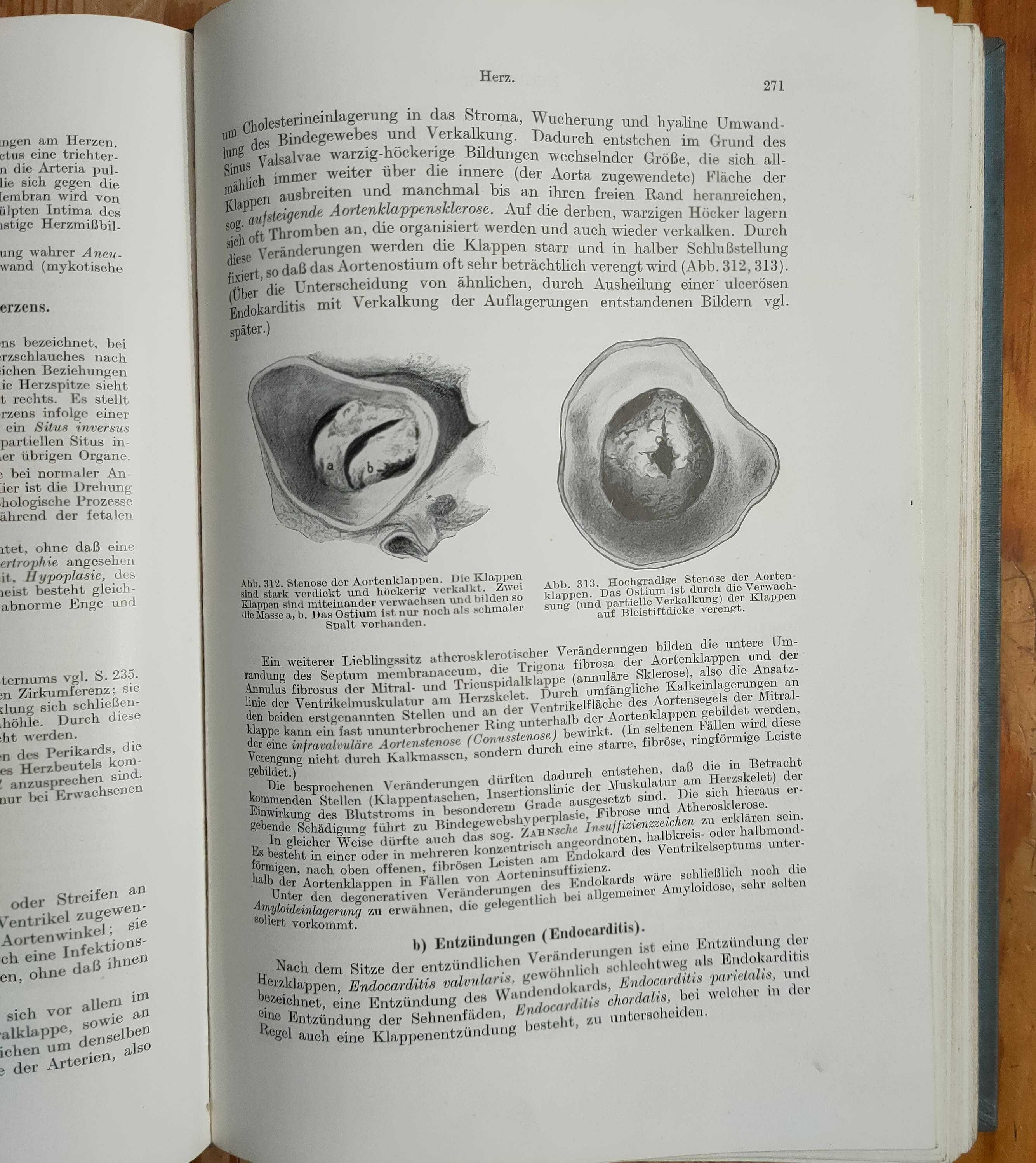 Lehrbuch der allgemeinen pathologie und der pathologischen anatomie