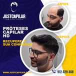 Prótese capilar Micro pele com colocação e corte, efeito real!