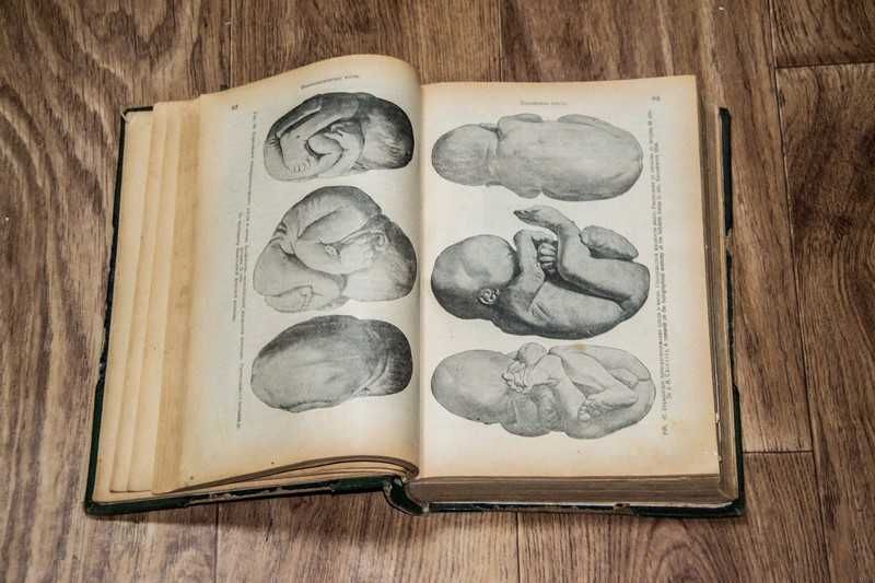 Книга "Акушерство" проф. Эрнст Бумм  1924 г