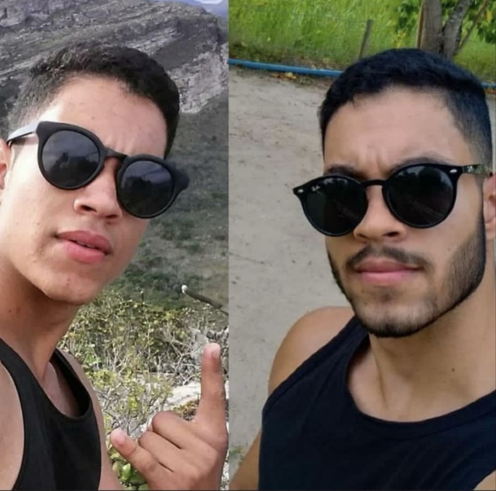 Minoxidi kirkland! Crescimento barba e cabelo
