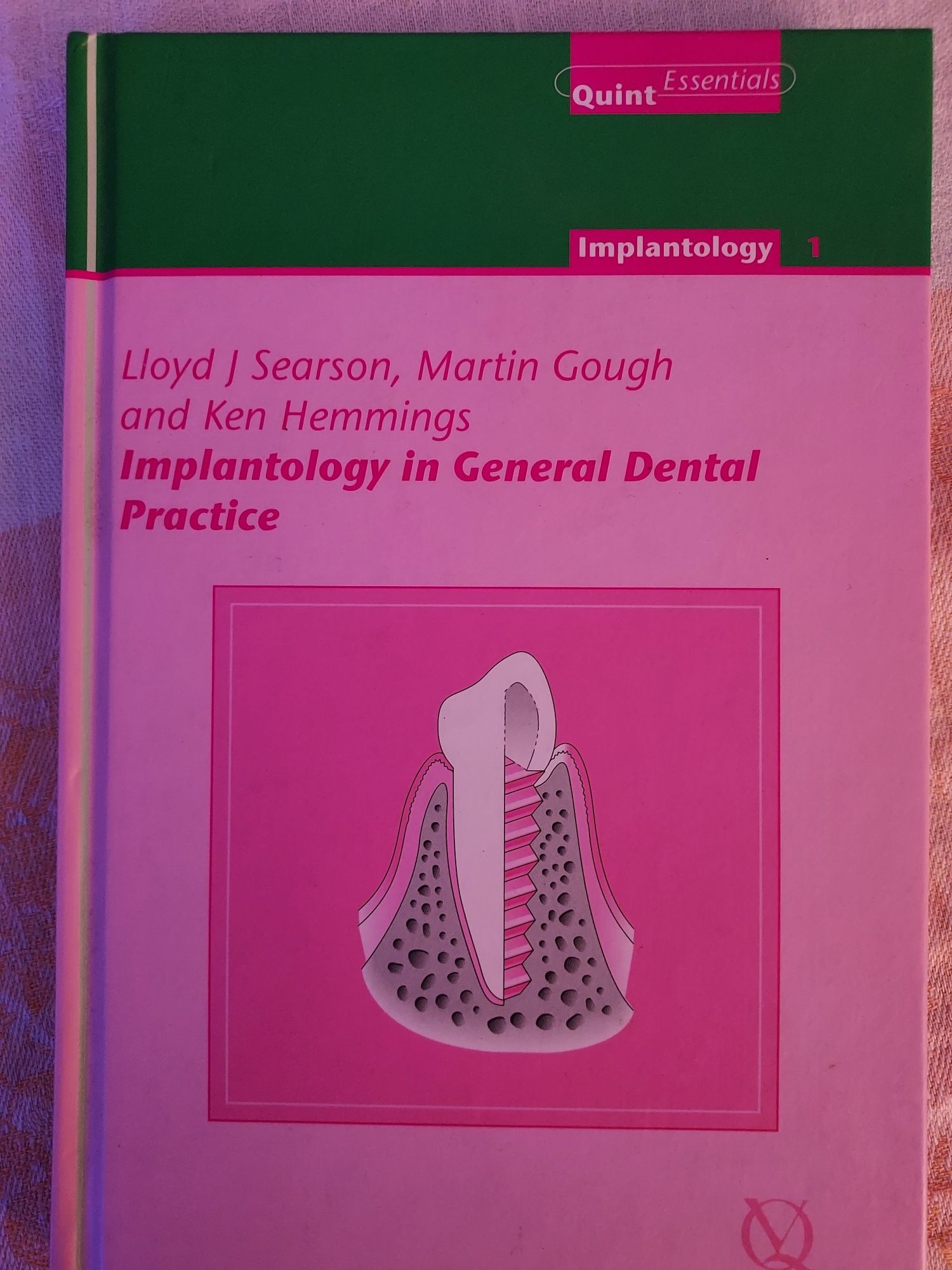 Livro de implantes dentários para generalistas.