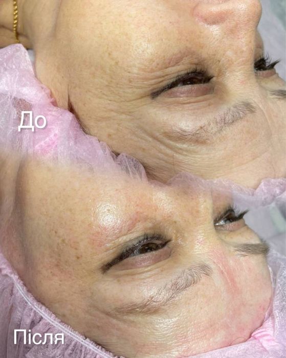 Косметолог Харків, м.Ярослава Мудрого