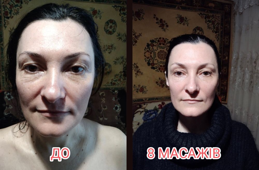 Костоправ. Масажист. Реабілітолог.Вісцеральний тарапевт. Масаж обличчя