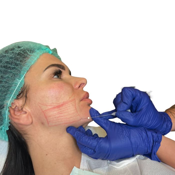 Uslugi medycyny estetycznej (botoks, stymulatory, kwas hialuronowy)