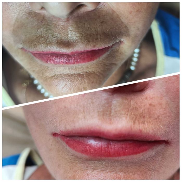 Опытный косметолог | Чистки, пилинги, инъекции