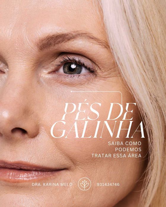 Remoçao de pigmentos a Laser