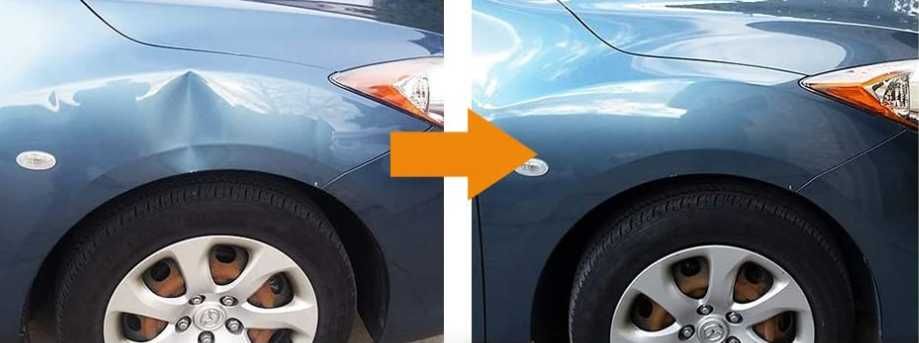 Kit tira mossas NOVO