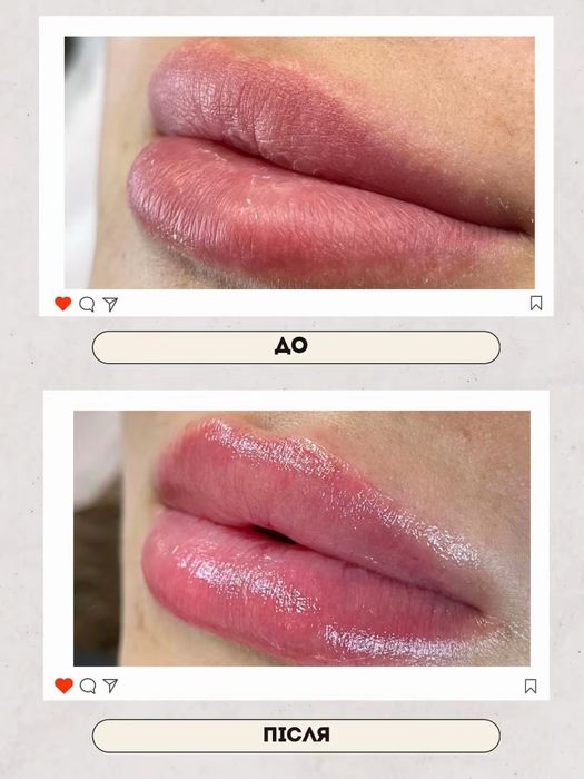 Косметолог Харків, м.Ярослава Мудрого