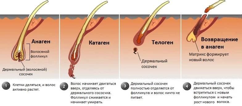 Электроэпиляция удалениние волос