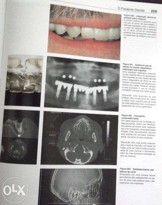 Odontologia Estetica-Atlas colorido