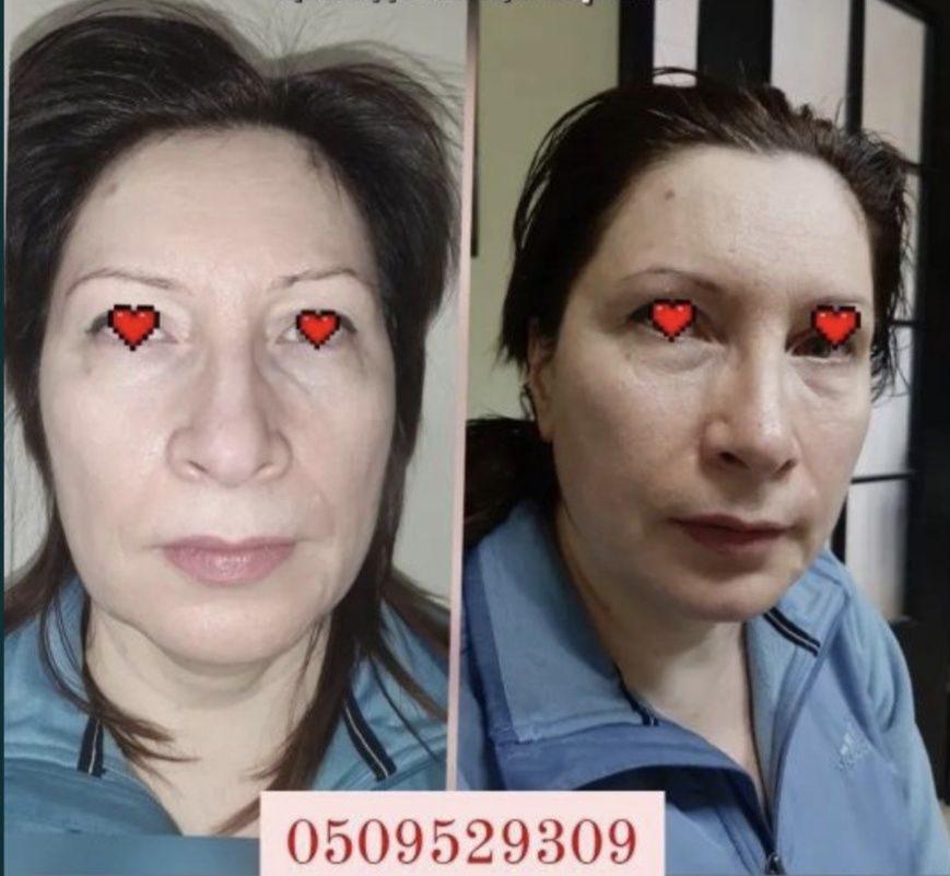 Масаж обличчя 3 техніки в одному масажі, міофасціальний, моделюючий, л
