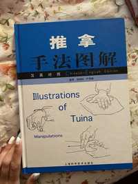 Illustrations of Tuina Manipulations