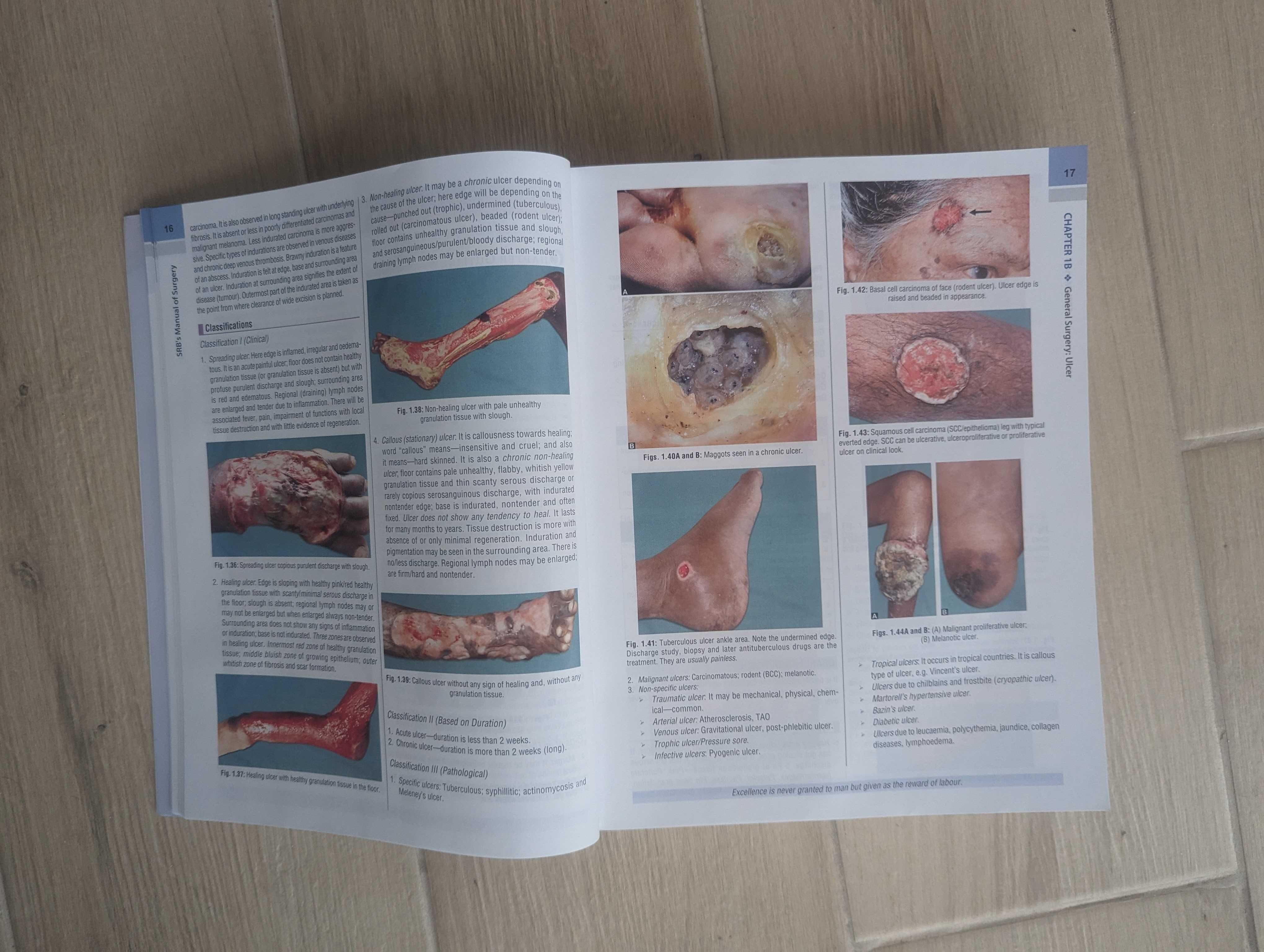 Srb's Manual of Surgery by BHAT M SRIRAm 6 видання книга підручник