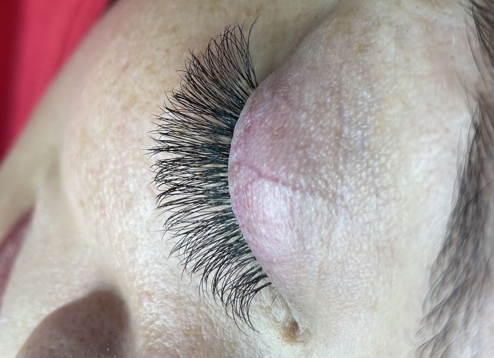 Електроепіляція, шугаринг,лазерна епіляція