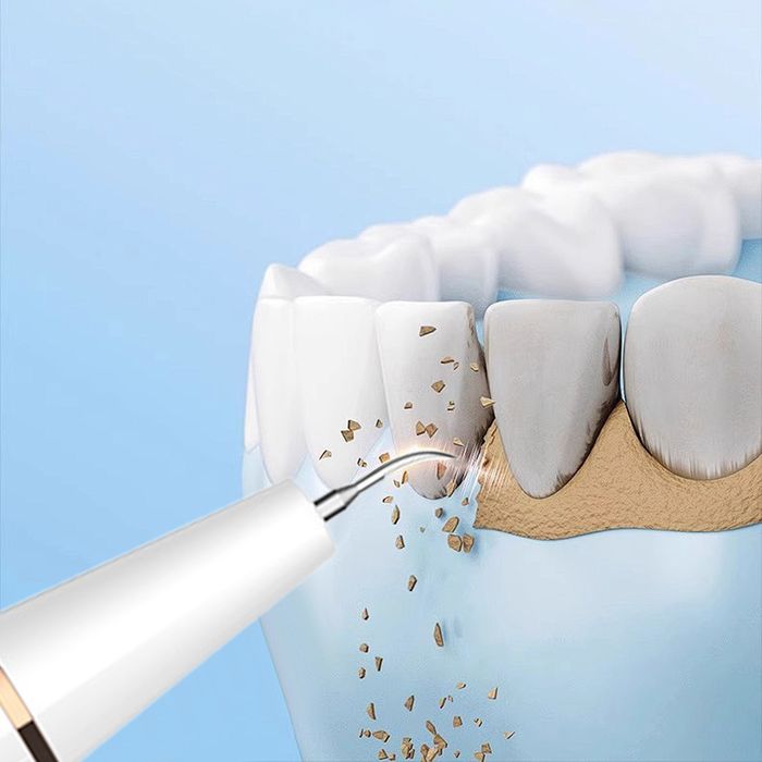 Ultradźwiękowy Środek Do Czyszczenia kamienia z Zębów