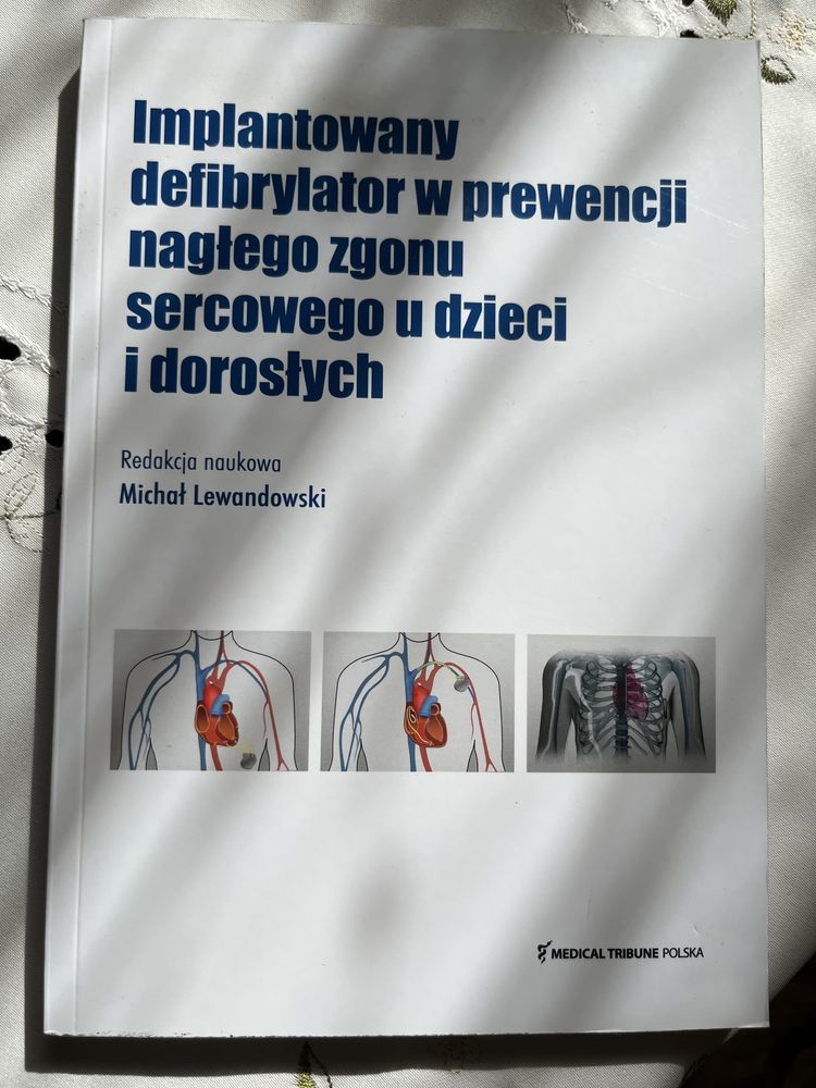 Implantowany defibrylator w prewencji nagłego zgonu sercowego