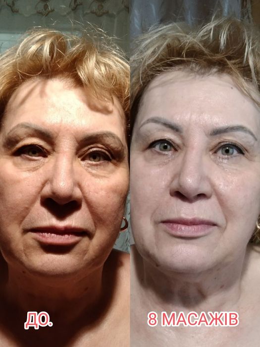 Костоправ. Масажист. Реабілітолог.Вісцеральний тарапевт. Масаж обличчя