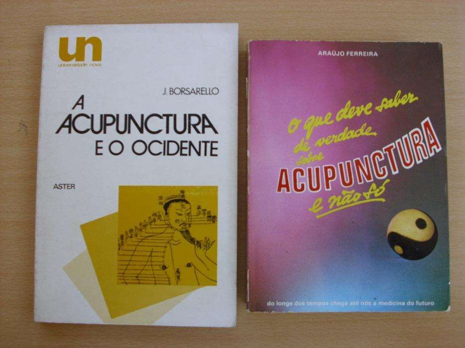 A Acupunctura