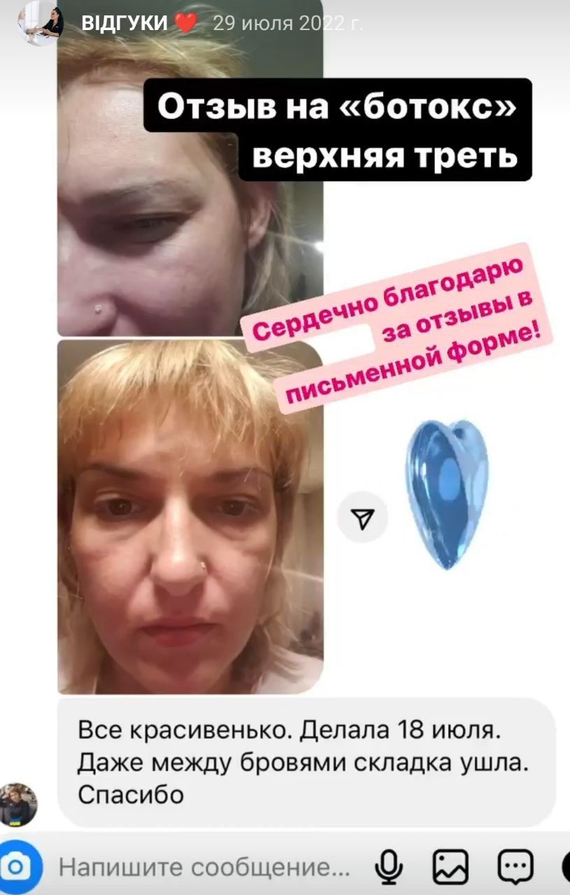 Збільшення губ, ботокс, біоревіталізація