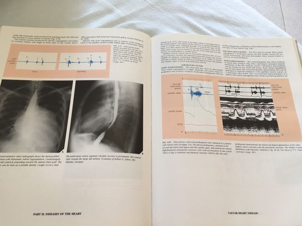 Vendo livro "Atlas of the Heart"