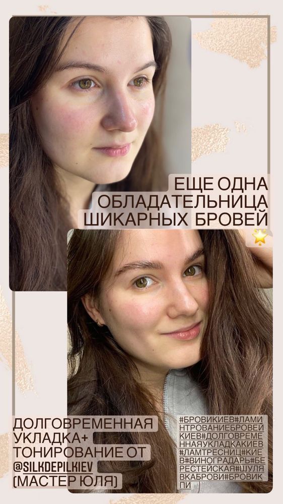 Косметологія, шугаринг, воскова депіляція Нивки,Святошино,Берестейська