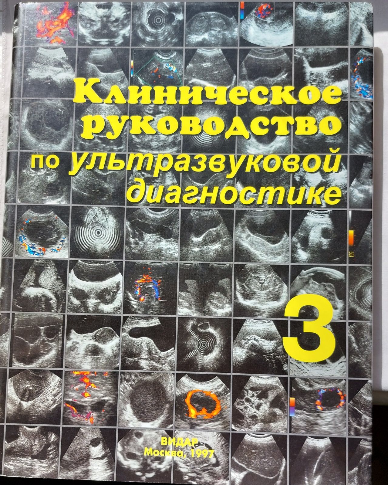 Клиническое руководство по ультразвуковой диагостике, Видар. Том 1,3 4