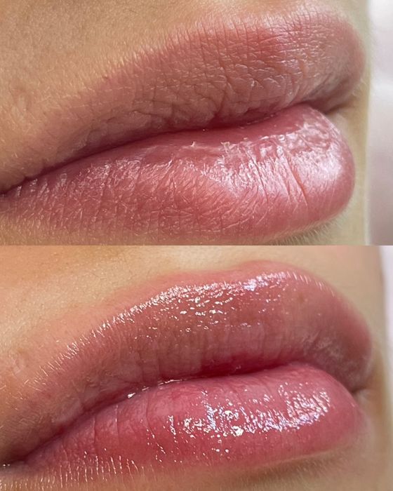 Косметолог Харків, м.Ярослава Мудрого