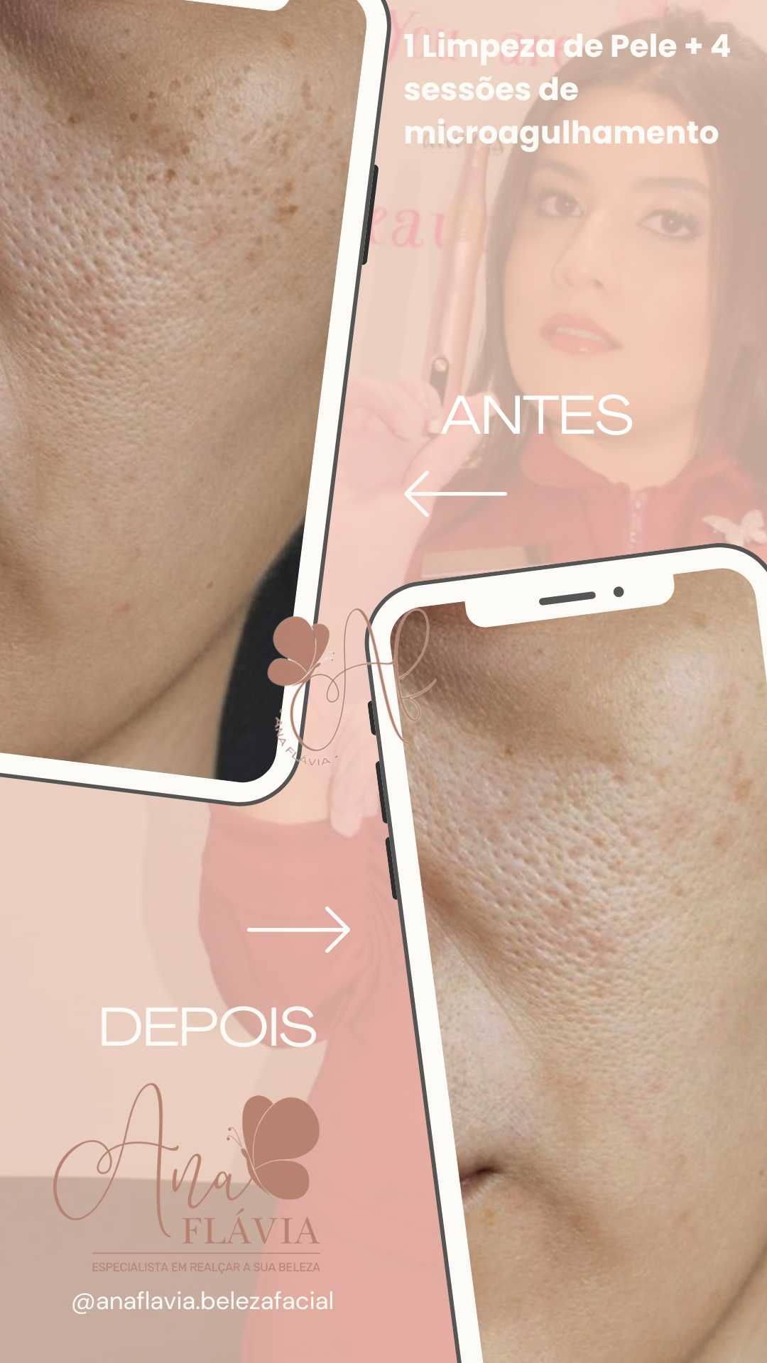 Estética Facial Ana Flávia Martins